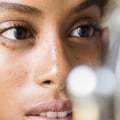 Acne Treatment: A Comprehensive Overview
