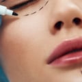 Everything You Need to Know About Injectable Treatments