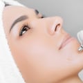 Everything You Need to Know About Oxygen Facials