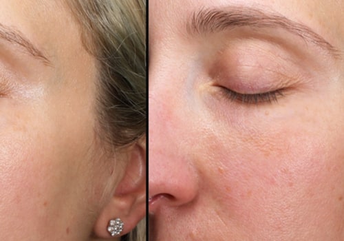 Anti-aging Treatments: An In-depth Look