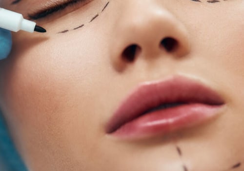 Everything You Need to Know About Injectable Treatments