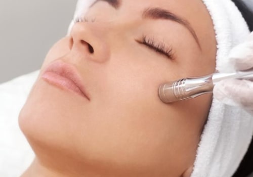 Everything You Need to Know About Microdermabrasion Facials