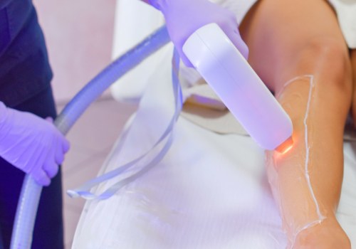 The Benefits and Drawbacks of Laser Treatments